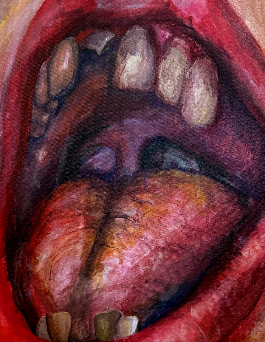 painting of a mouth with rotten teeth